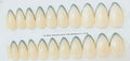 Creamy French GREEN Tips